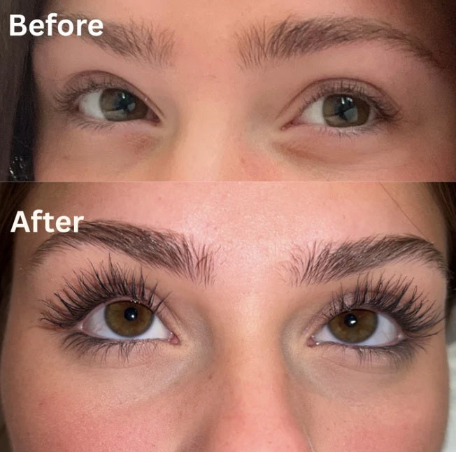 LashBoost™ Eyelash Growth Serum
